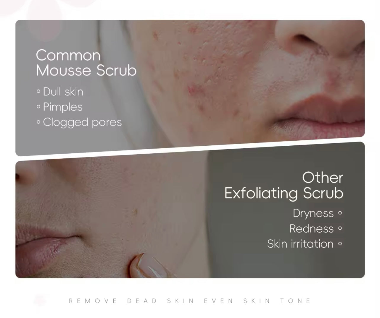 Gel Peeling Exfoliant Visage & Corps